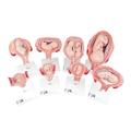 3B Scientific Pregnancy Series, 8 Models - w/ 3B Smart Anatomy 1018627